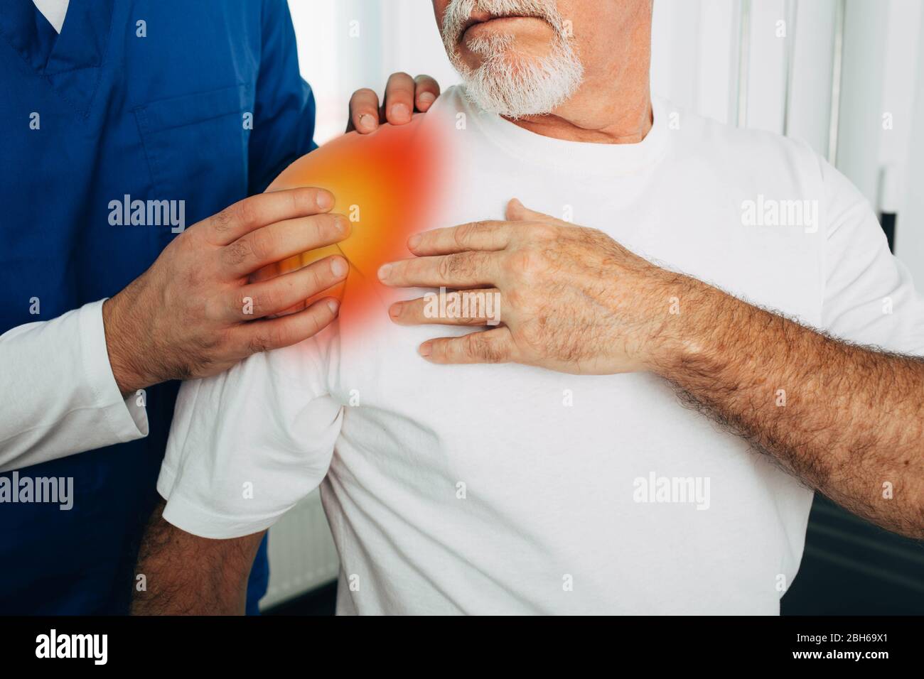 patient with arthritis of the shoulder joint. Pain localized in shoulder Stock Photo