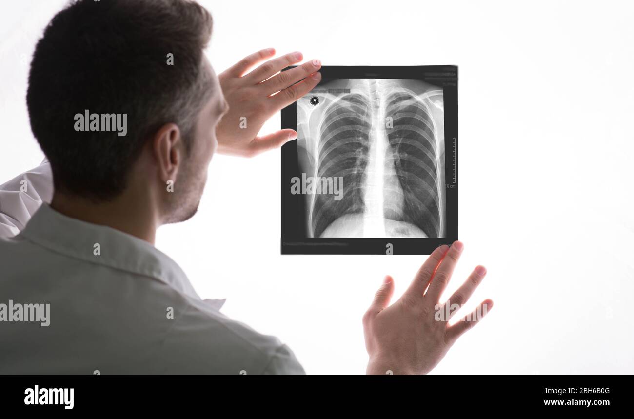 radiologist exam an x-ray of the lungs. lung diseases, treatment, pneumonia Stock Photo