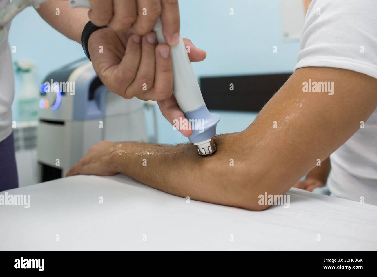 https://c8.alamy.com/comp/2BH6BGK/procedure-shock-wave-therapy-at-clinic-physiotherapist-treatment-pain-on-the-arm-with-shock-wave-equipment-2BH6BGK.jpg