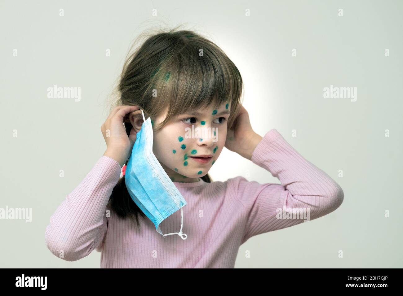 Child girl wearing blue protective medical mask ill with chickenpox, measles or rubella virus with rashes on body. Children protection during epidemic Stock Photo