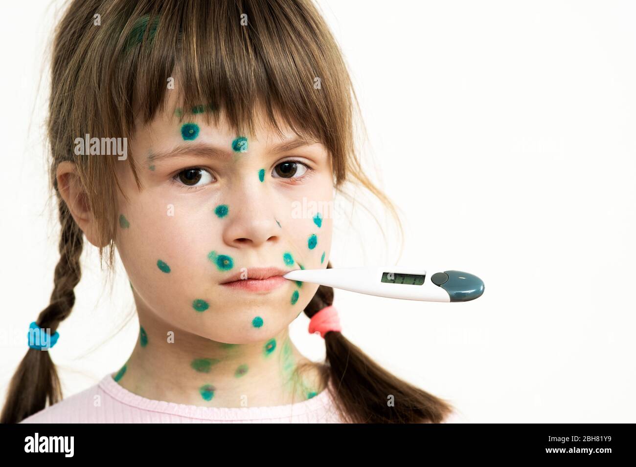 Child girl covered with green rashes on face ill with chickenpox, measles or rubella virus holding medical thermometer in her mouth having high temper Stock Photo