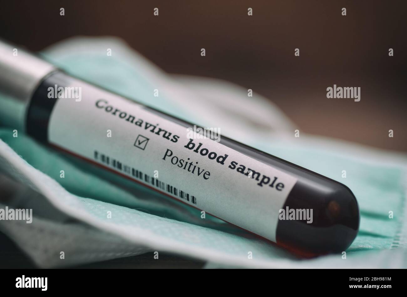 Coronavirus 2019-nCoV Blood Sample. Epidemic virus Respiratory Syndrome stock photo. Corona virus outbreak. Stock photo of  tube with Blood Test(novel Stock Photo