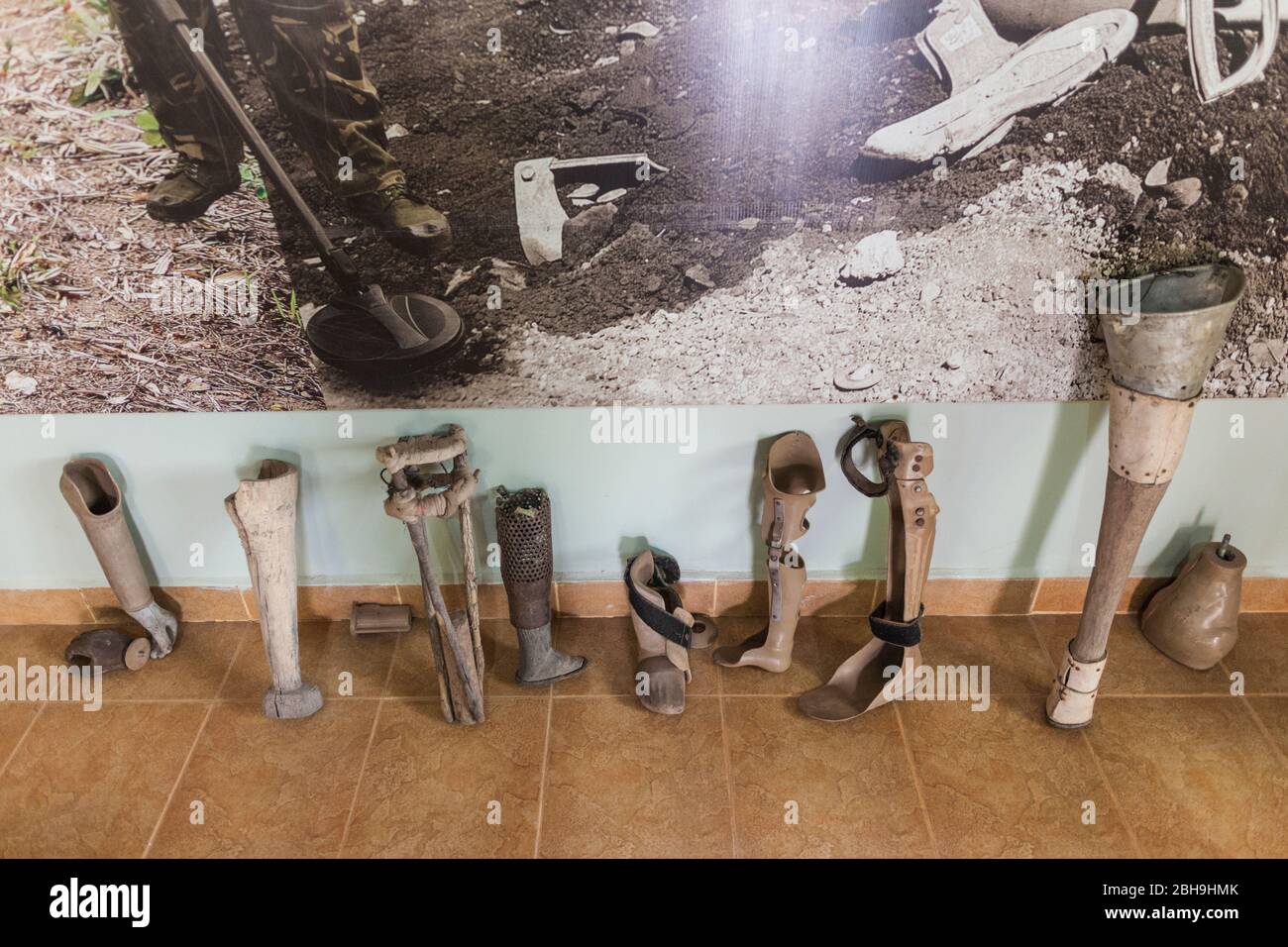 Cambodia, Siem Reap, Landmine Museum, run by unexploded ordnance orgaization, home made leg prosthesis Stock Photo