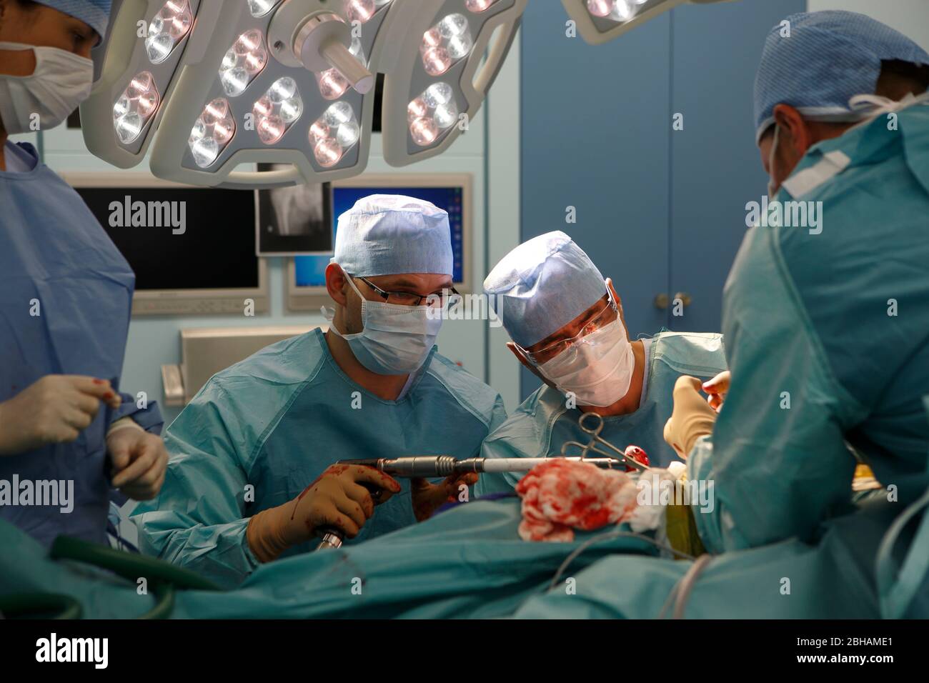 Surgeons performing a hip replacement Stock Photo