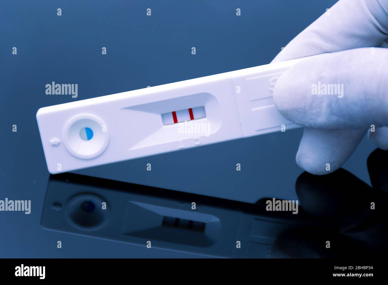 The positive result of quick urine test Stock Photo Alamy