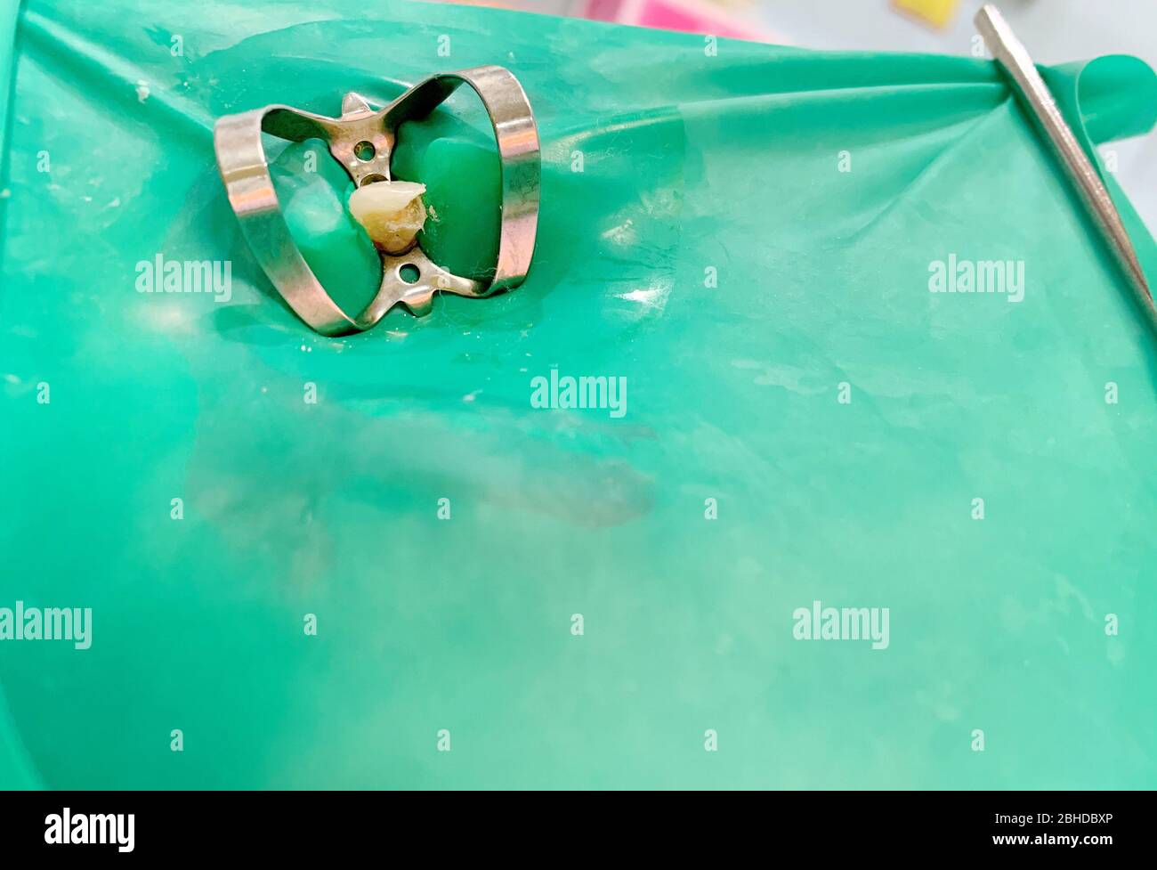 The green rubber dam isolation on decayed tooth with metal clamp for