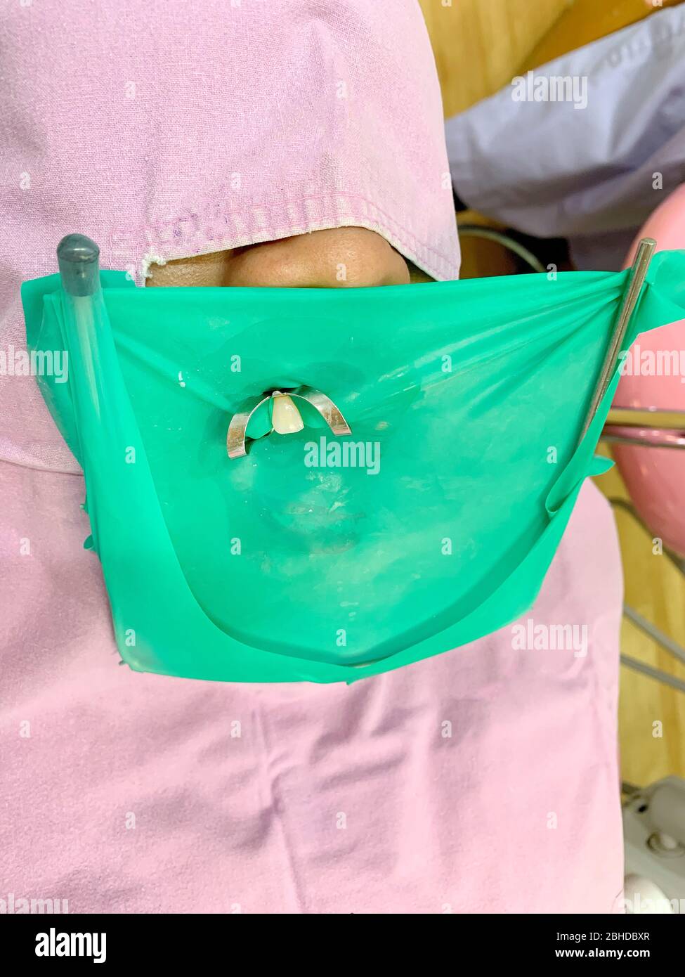 The green rubber dam isolation on tooth with metal clamp for dental