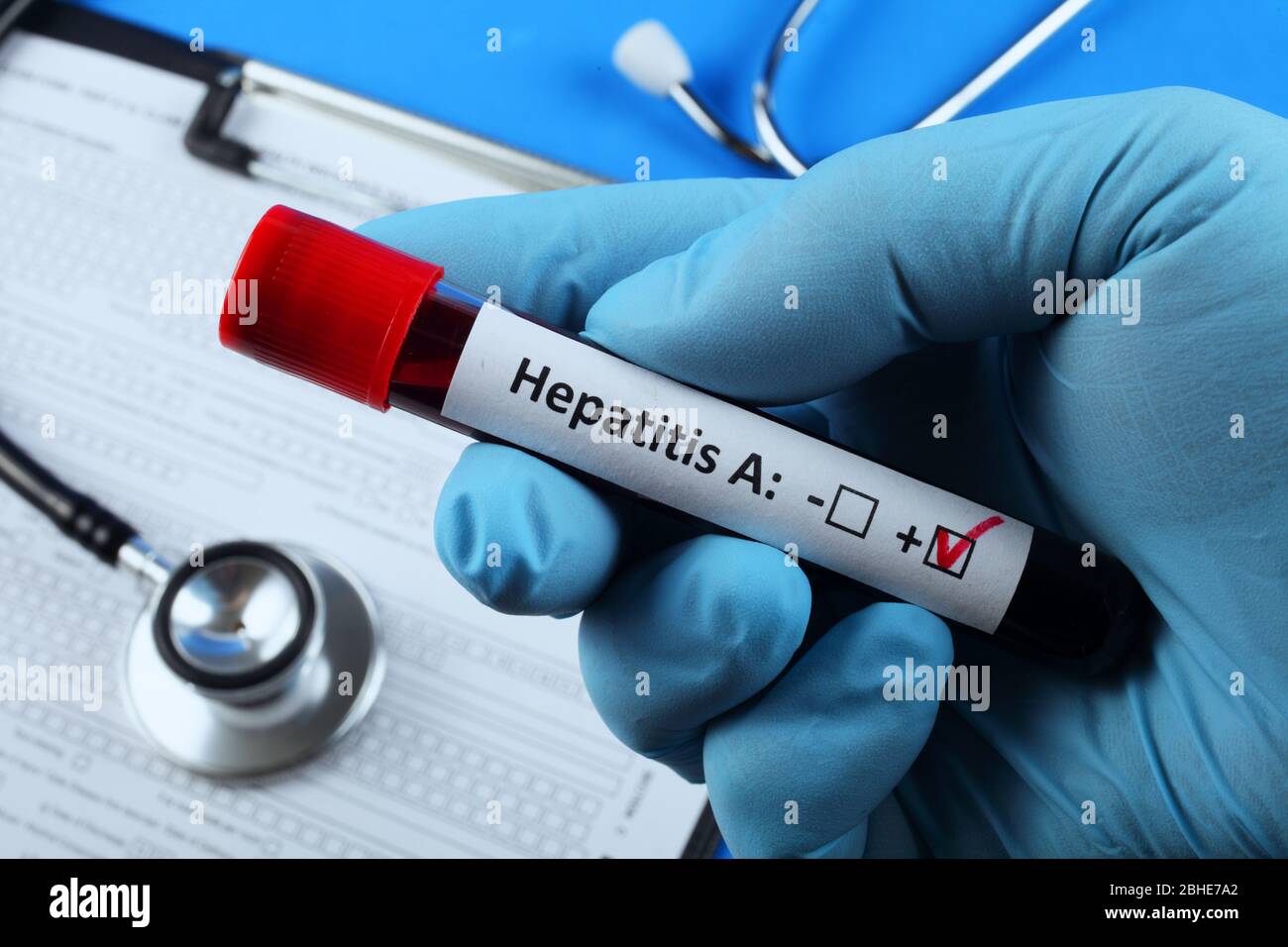 Кровь на вирусные маркеры. Исследование крови гепатит картинки. Blood Test Hepatitis b. Анализ ручка. Вирусная кровь картинка.
