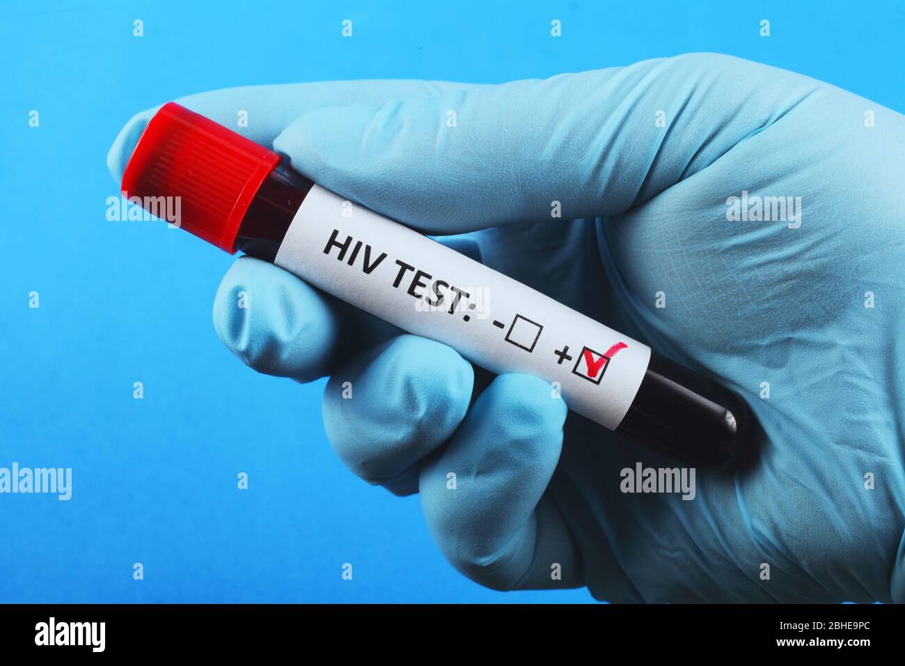 Vacuum test tube with blood in the doctor's hand. blood test for
