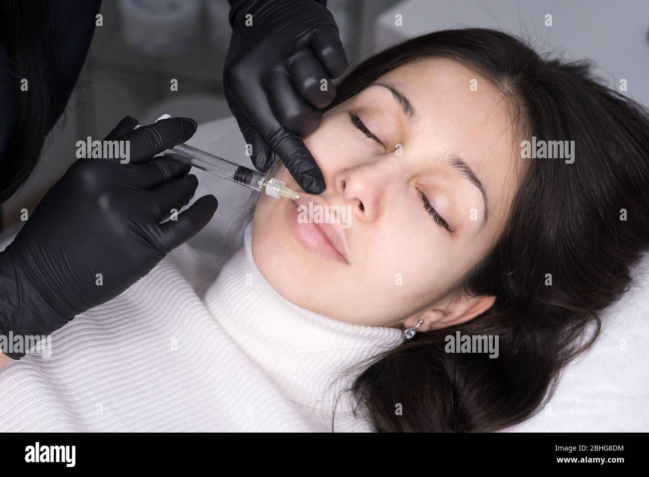 Injections of the lips. Adjustment of the lower lip form. Injection of ...