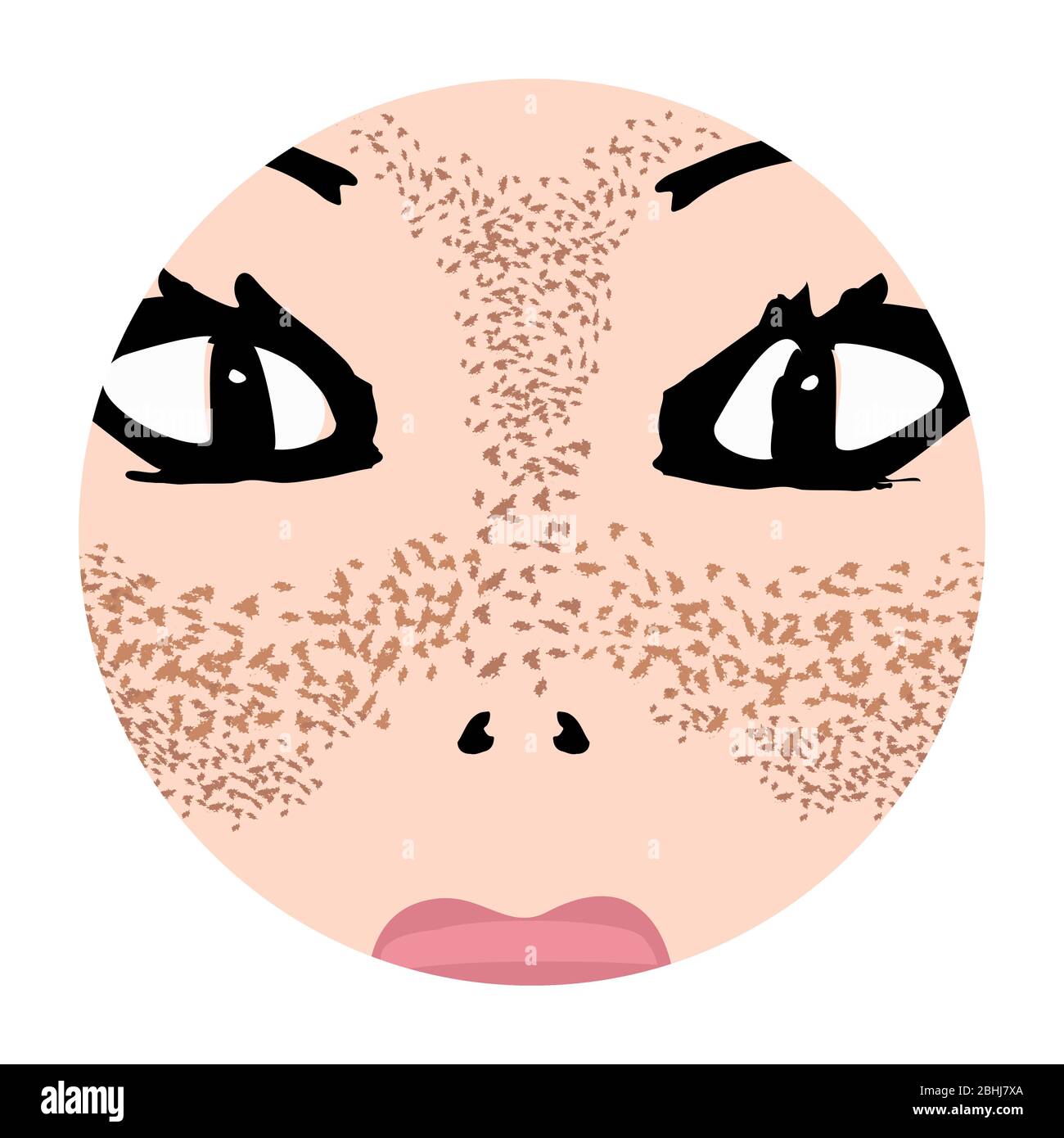 Freckles on the face. Pigmentation on the skin. A pigmented spot on the skin of the face. Before