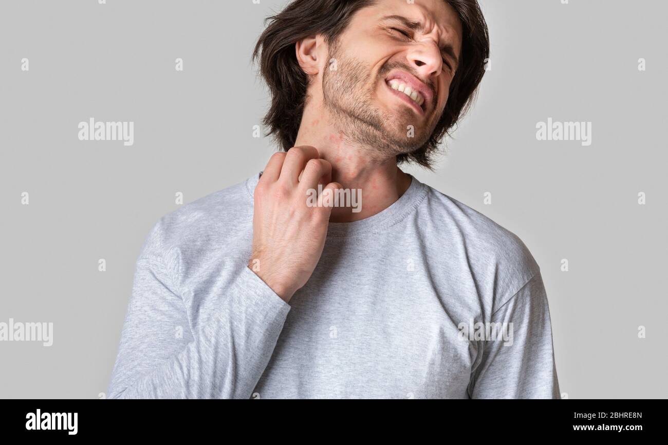 Allergy rash. Man suffering from itching on skin and scratching throat Stock Photo
