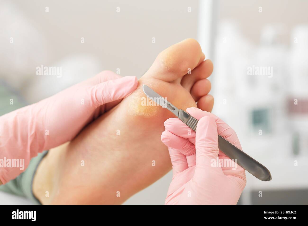 Medical pedicure procedure using special instrument with blade knife ...