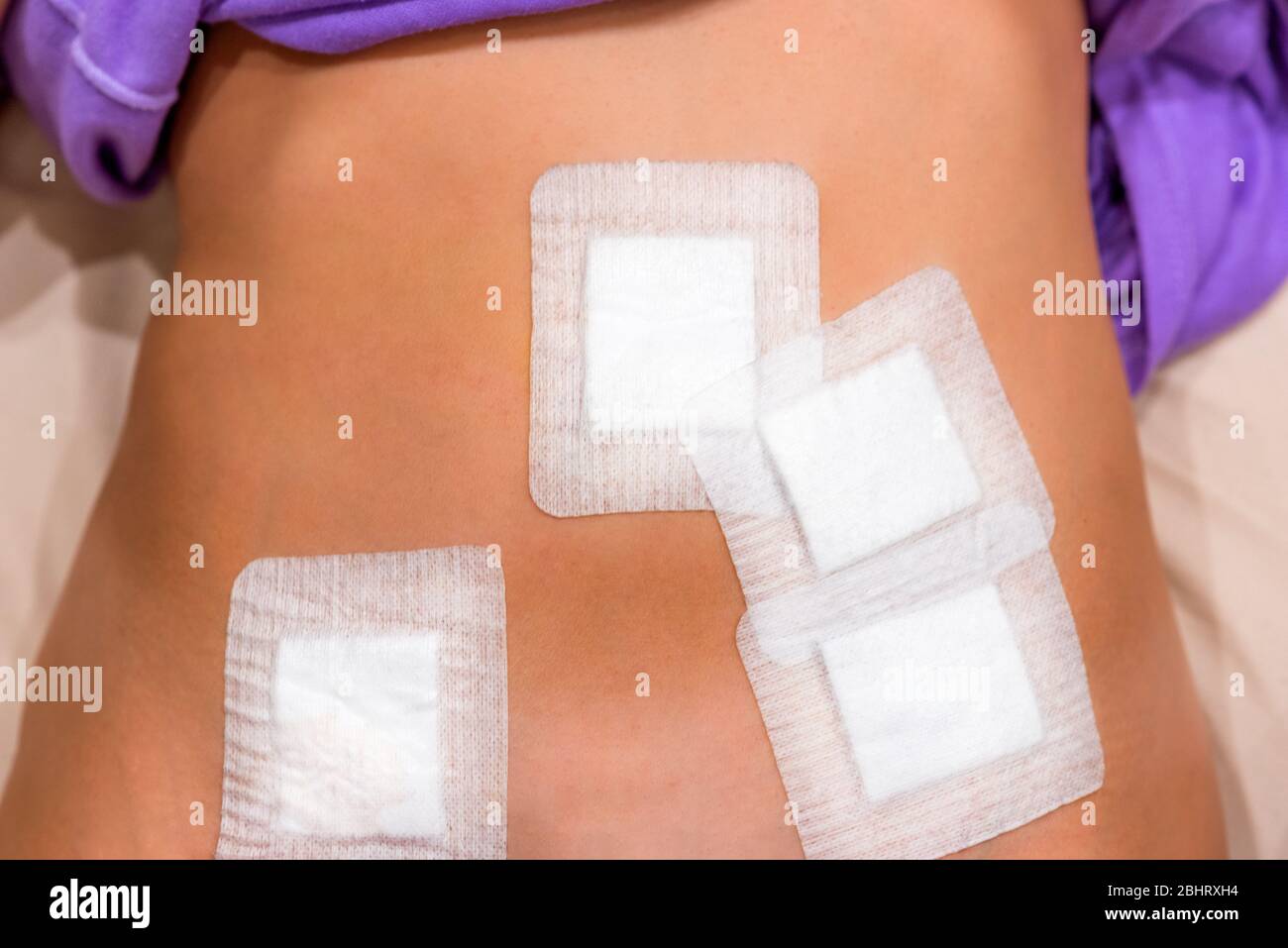 Laparoscopic hires stock photography and images Alamy