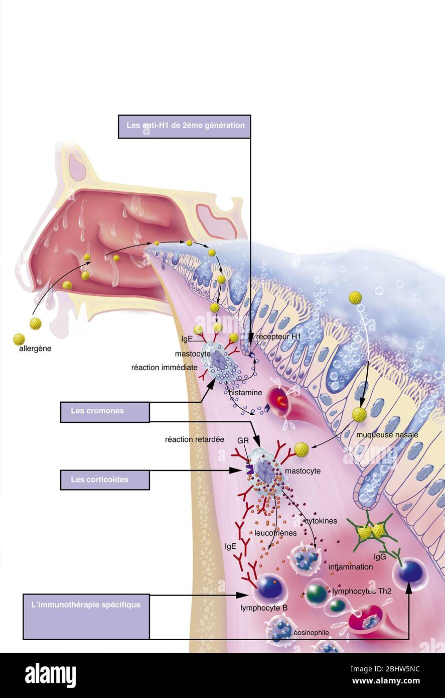 Nasal Congestion Detail Of Nasal Mucosa Allergen Allergic Reaction