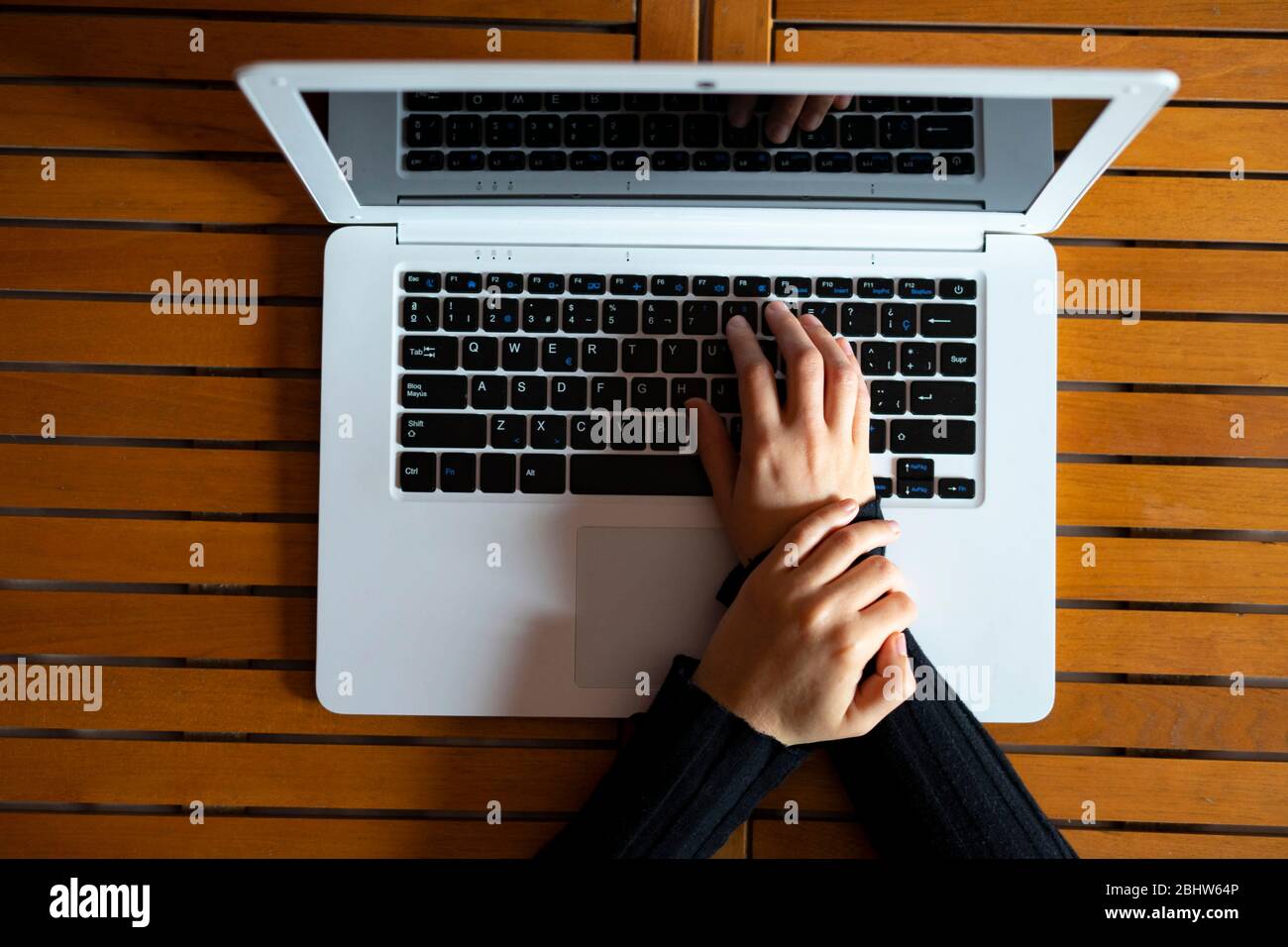 Woman with wrist pain from working with the computer. Ergonomics at work concept. Stock Photo