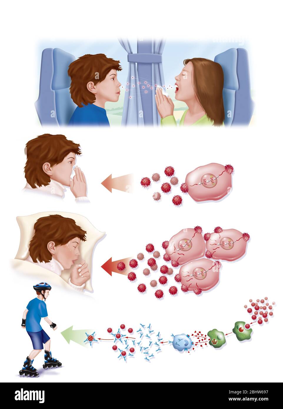 Replication of the cold virus until healing. The story begins with a sick child who coughs and infects the boy in front of her. The virus in the boy's Stock Photo
