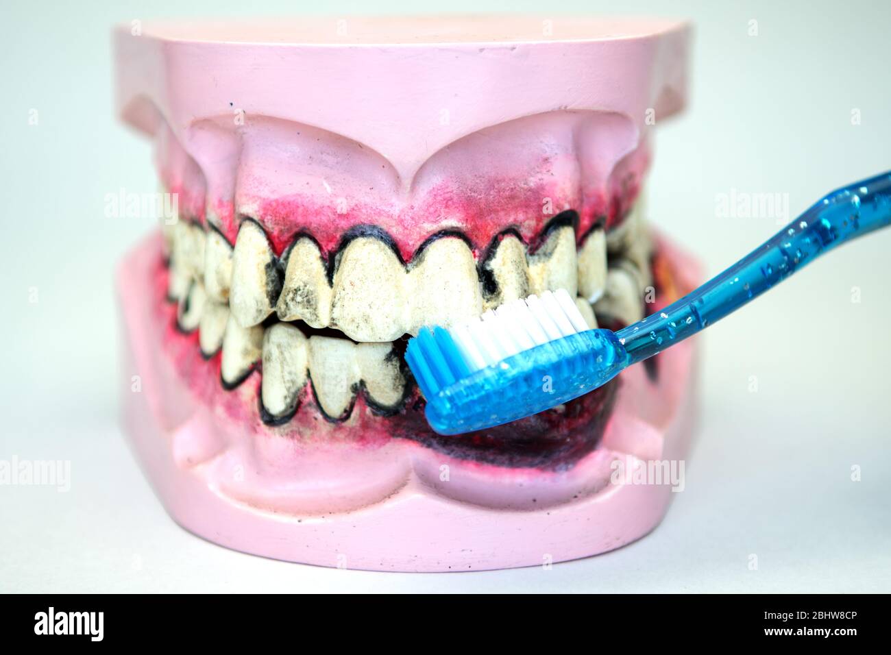 Toothbrush cleaning wooden dentures with caries and cavities on white ...