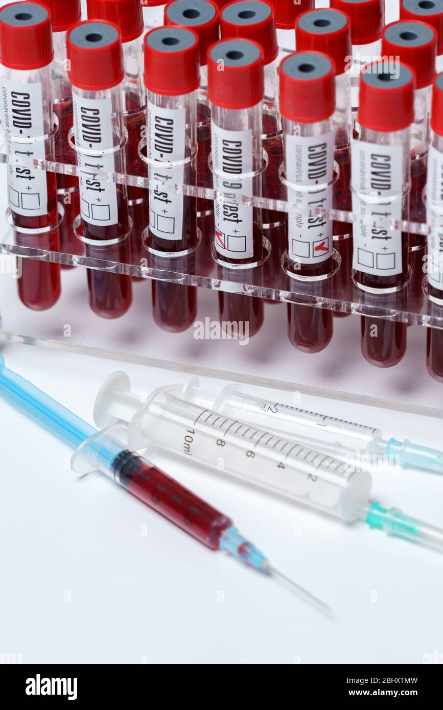 Rack of Tubes of blood sample for testing biological material Stock