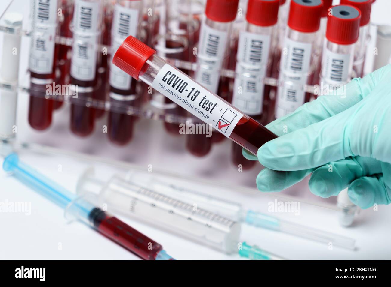Rack of Tubes of blood sample for testing biological material Stock ...