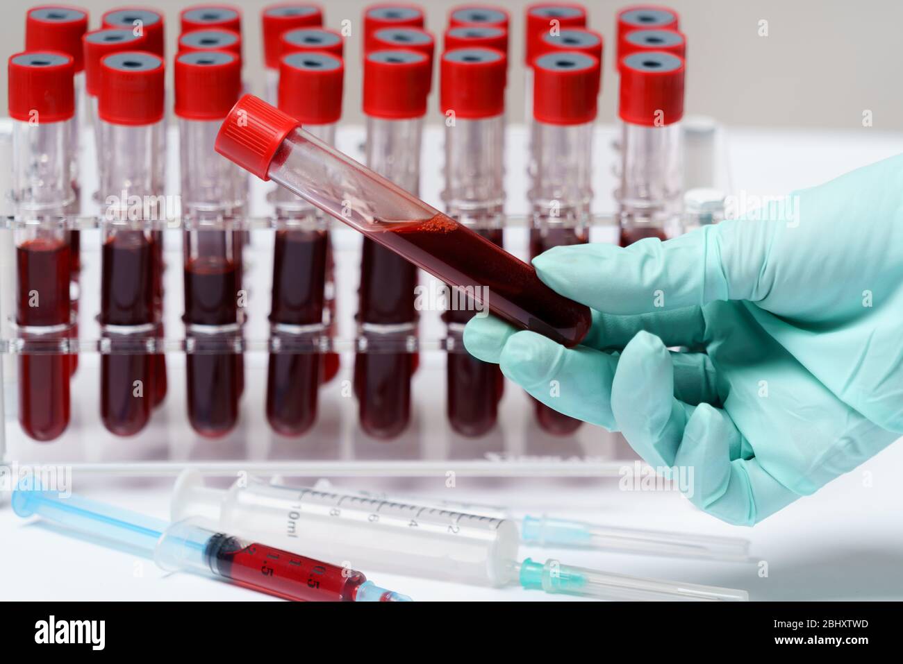 Rack of Tubes of blood sample for testing biological material Stock ...