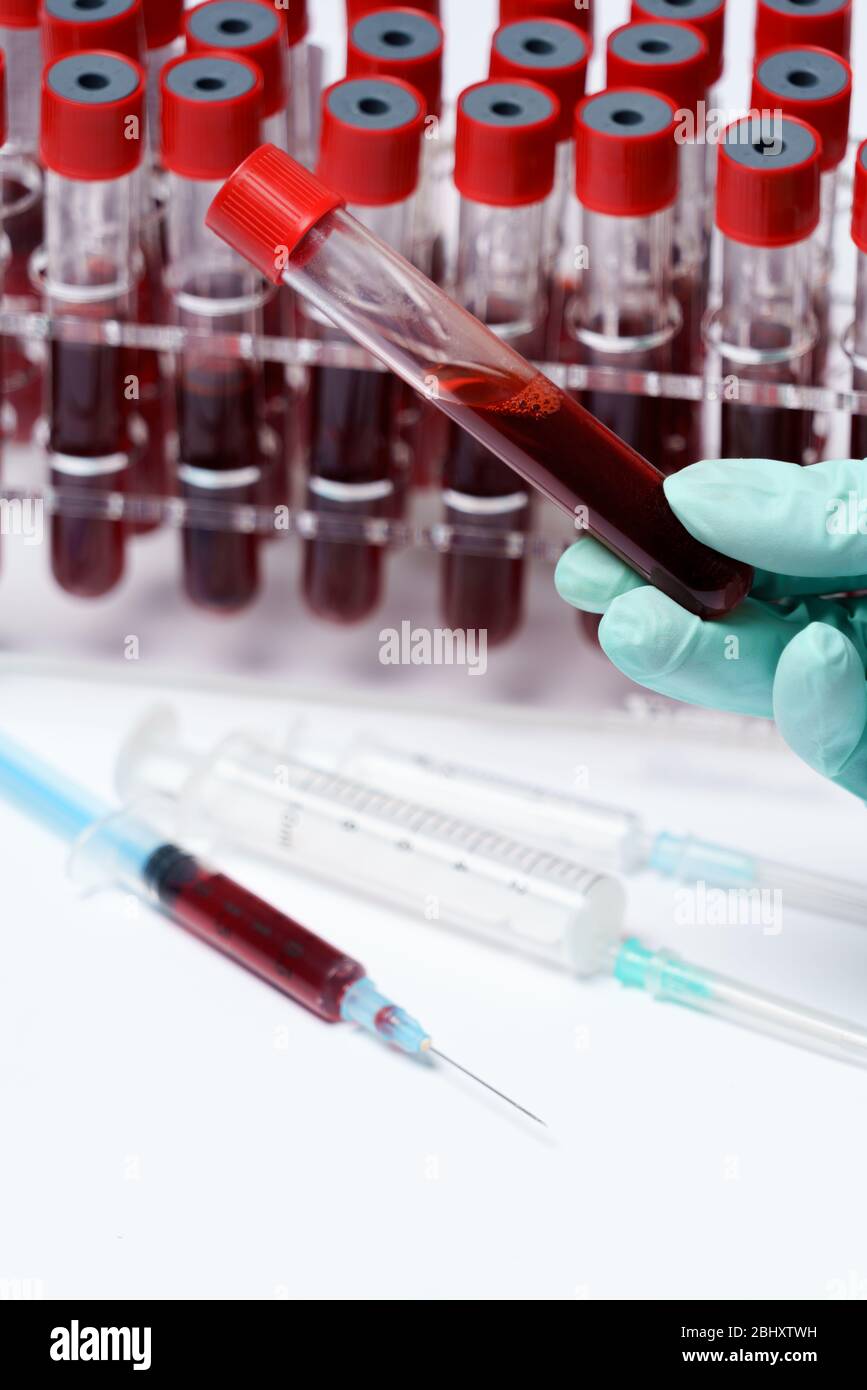 Rack of Tubes of blood sample for testing biological material Stock ...