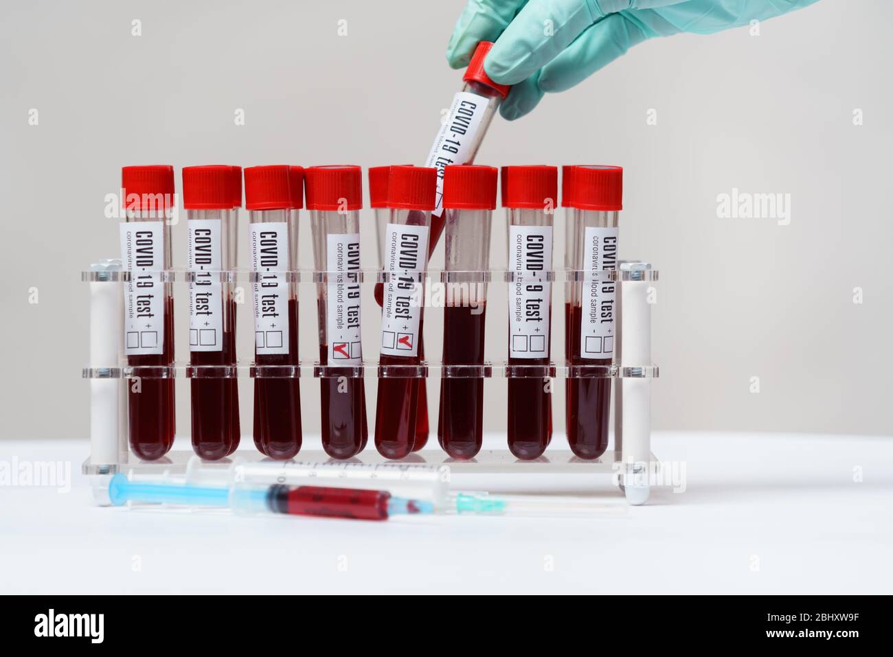 Rack of Tubes of blood sample for testing biological material Stock