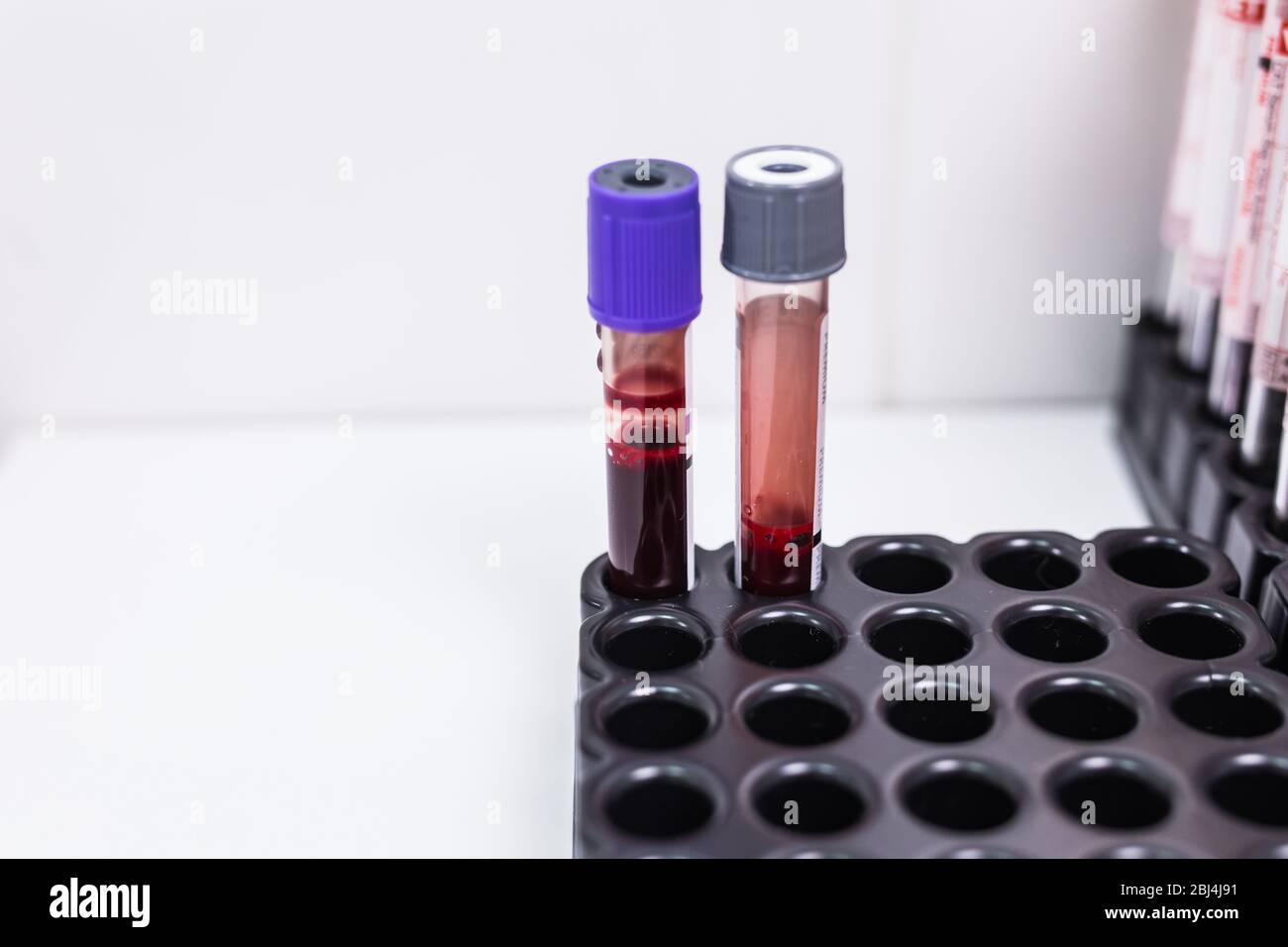 Covid19, pandemic and coronavirus concept blood in tests tubes in