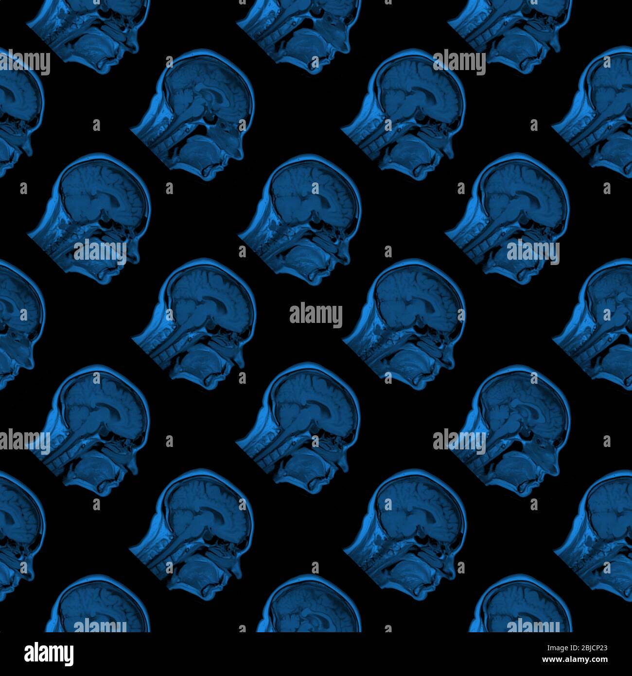 seamless pattern of MRI scans of sixty years old caucasian female head in sagittal or longitudinal plane - classic blue color on black background Stock Photo