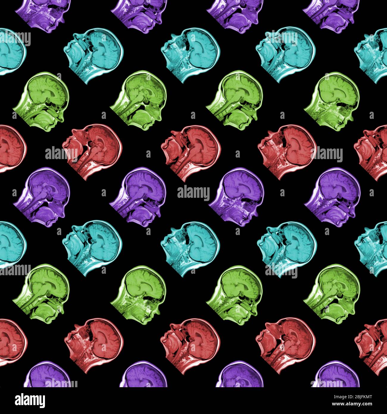 seamless pattern of MRI scans of sixty years old caucasian female head in sagittal or longitudinal plane - classic blue color on black background Stock Photo