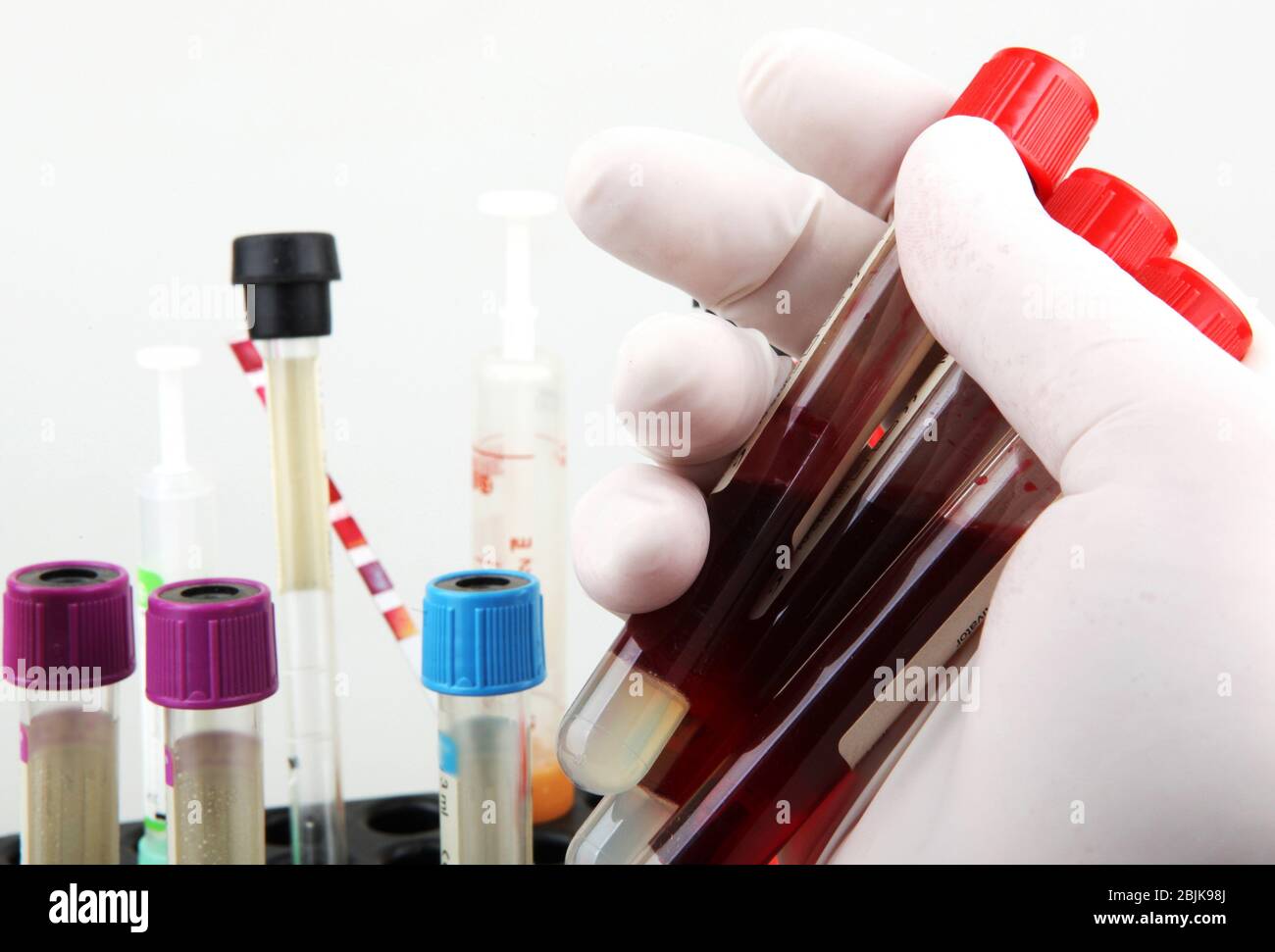 Биохимия сыворотки крови. Лабораторные исследования крови. Лаборатория крови. Лаборатория крови и биохимических исследований. Анализ крови лаборатория.