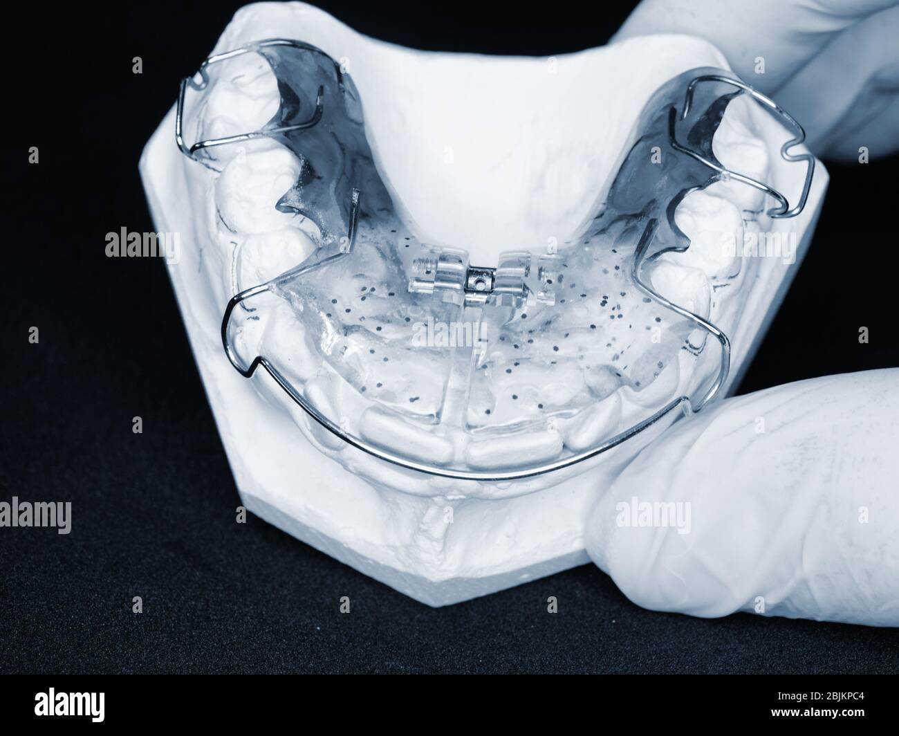 Orthodontic removable retainer. Dental Blue Removable Brace or Retainer