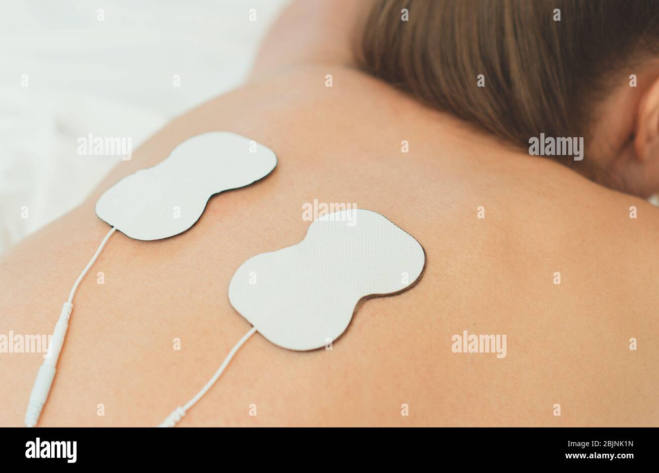 Woman body with electrodes on her back. Electrical muscle stimulation. Stock Photo