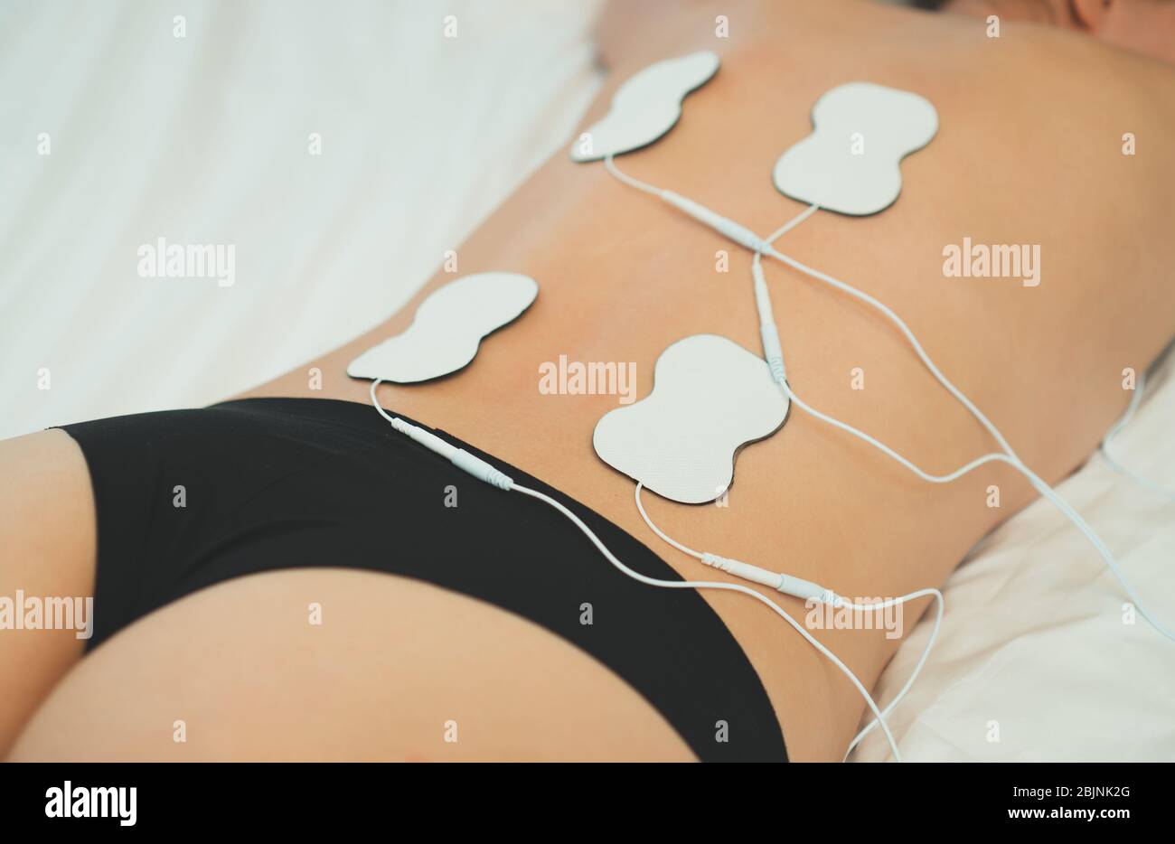 Woman body with electrodes on her back. Electrical muscle stimulation. Stock Photo