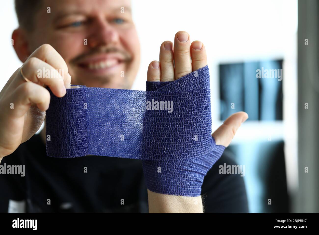Fracture bone and x ray image Stock Photo