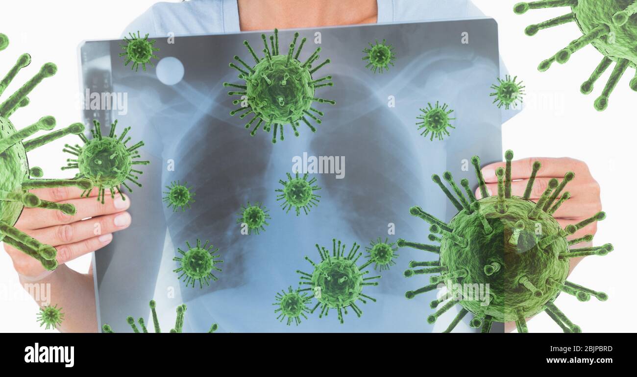 Digital illustration of woman holding x-ray photo over macro Coronavirus Covid19 cells floating Stock Photo