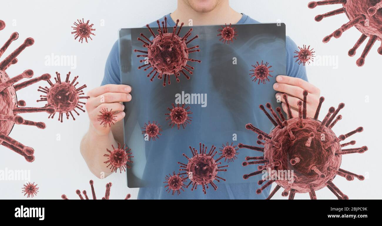 Digital illustration of a man holding a x-ray scan of his chest over macro Coronavirus Covid-19 cell Stock Photo