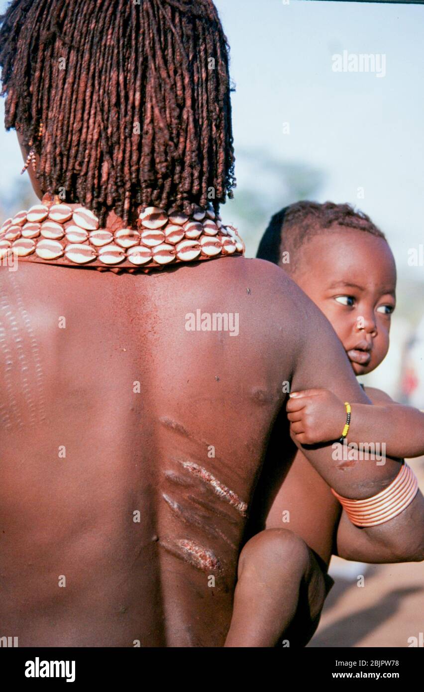 The raw scars on a Hamar woman's back after being whipped at a 'Jumping of the Bull' ceremony. Photographed in the Omo River Valley, Ethiopia Stock Photo