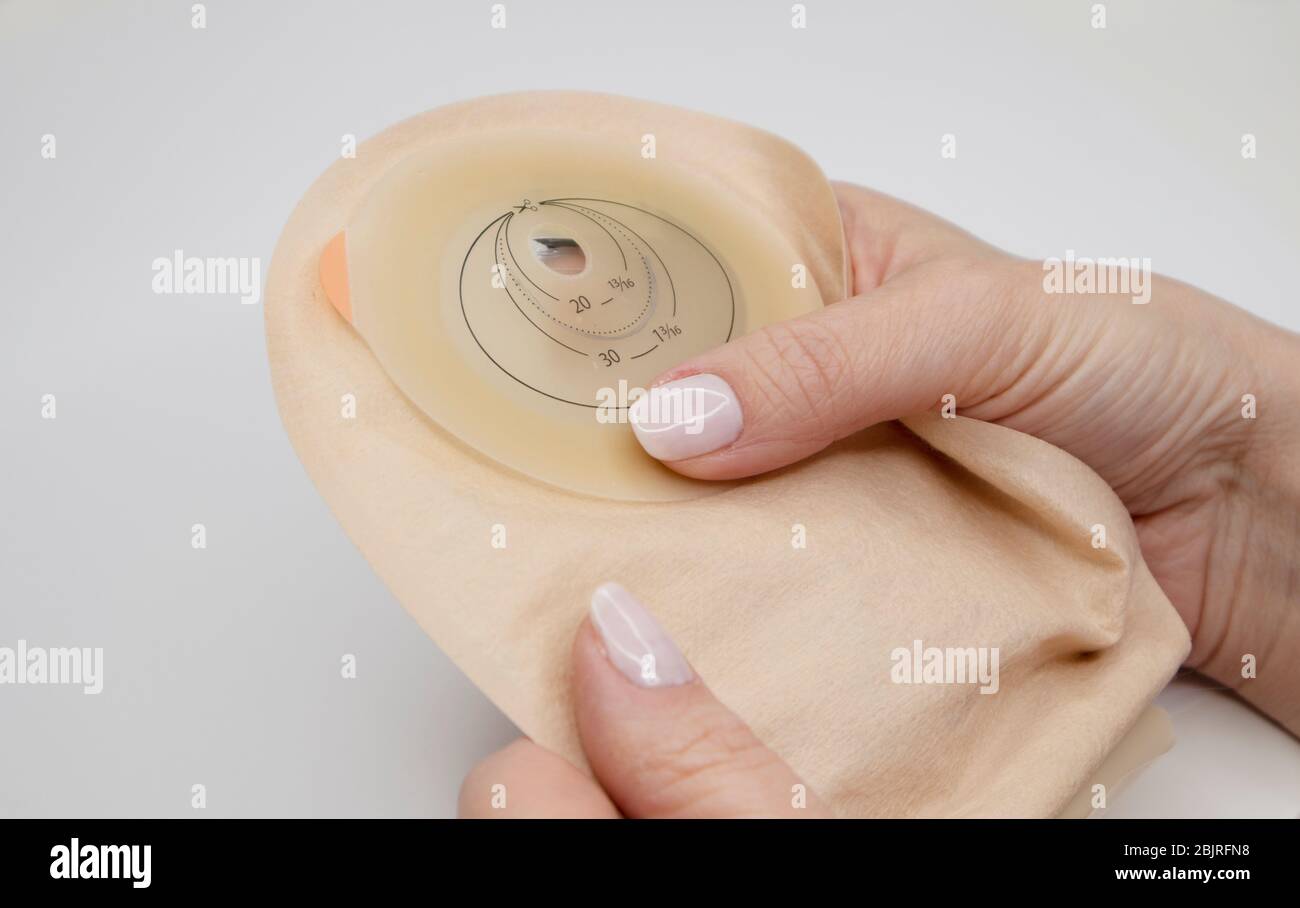 Top View On Colostomy Bag Needed After Colostomy Surgery Colon Cancer