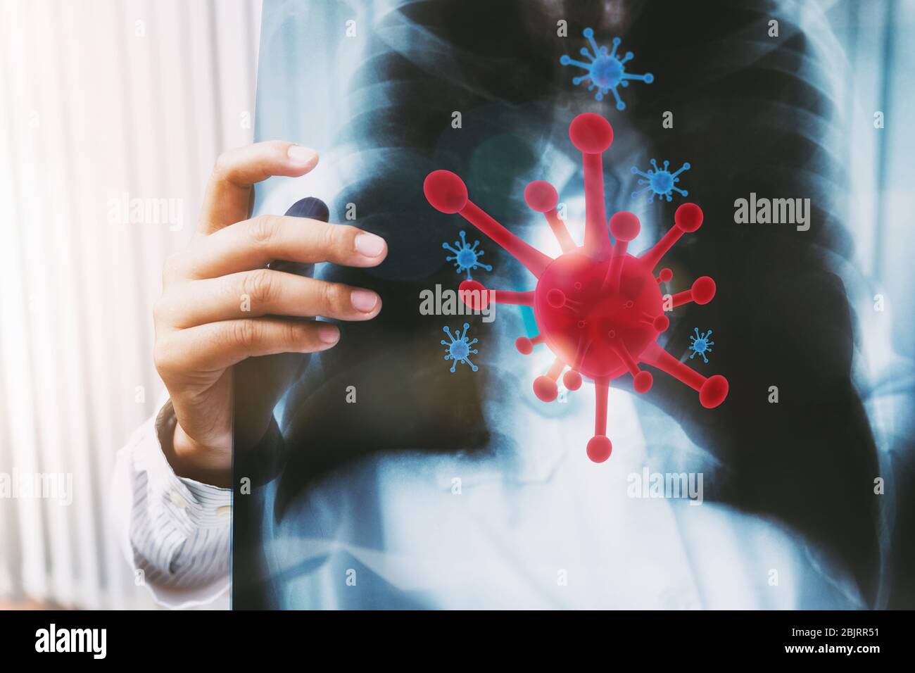 A doctor is diagnosing the results of the lung Xrays of patients