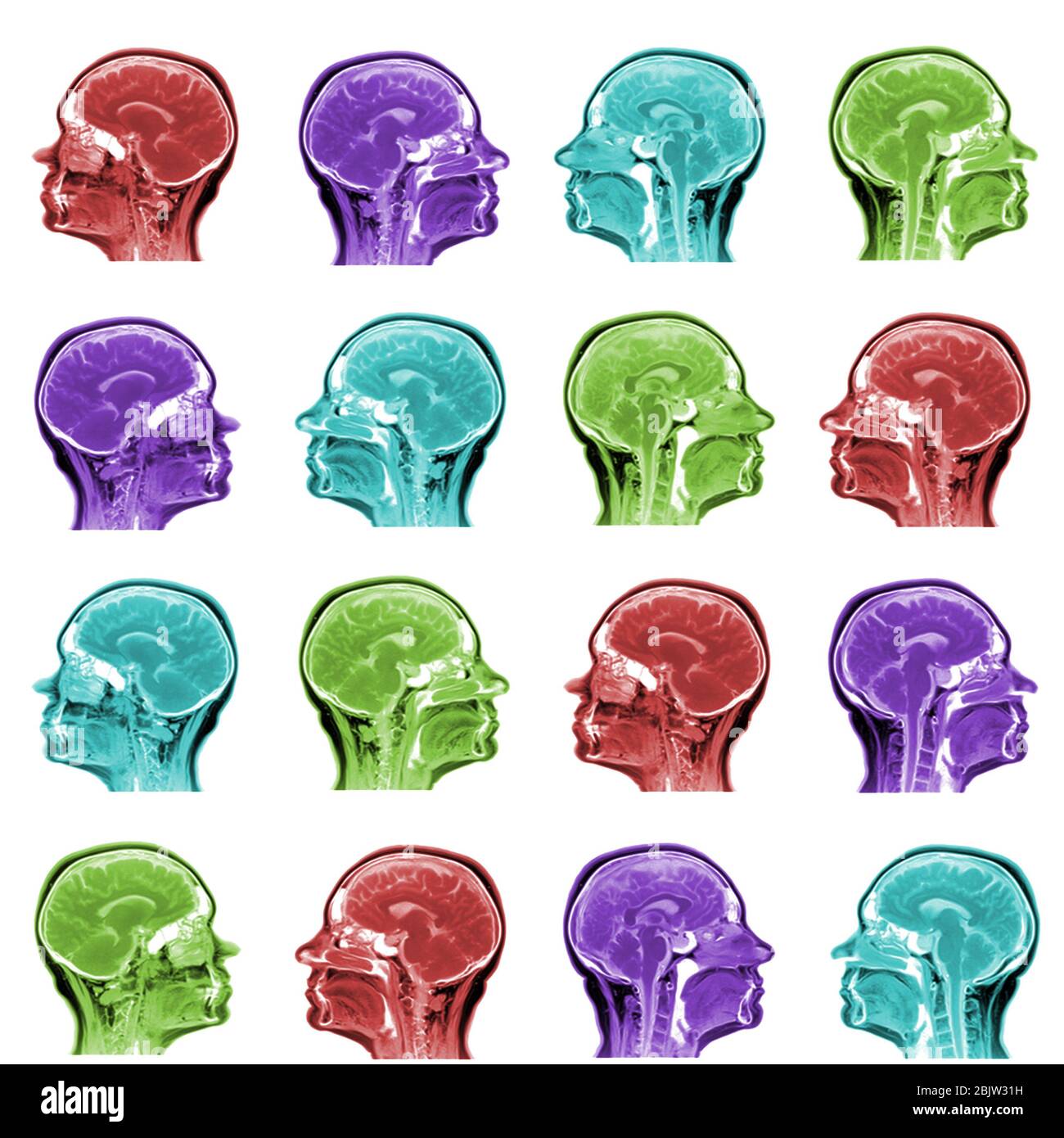 seamless pattern of MRI scans of sixty years old caucasian female head in sagittal or longitudinal plane - colored heads on white background Stock Photo