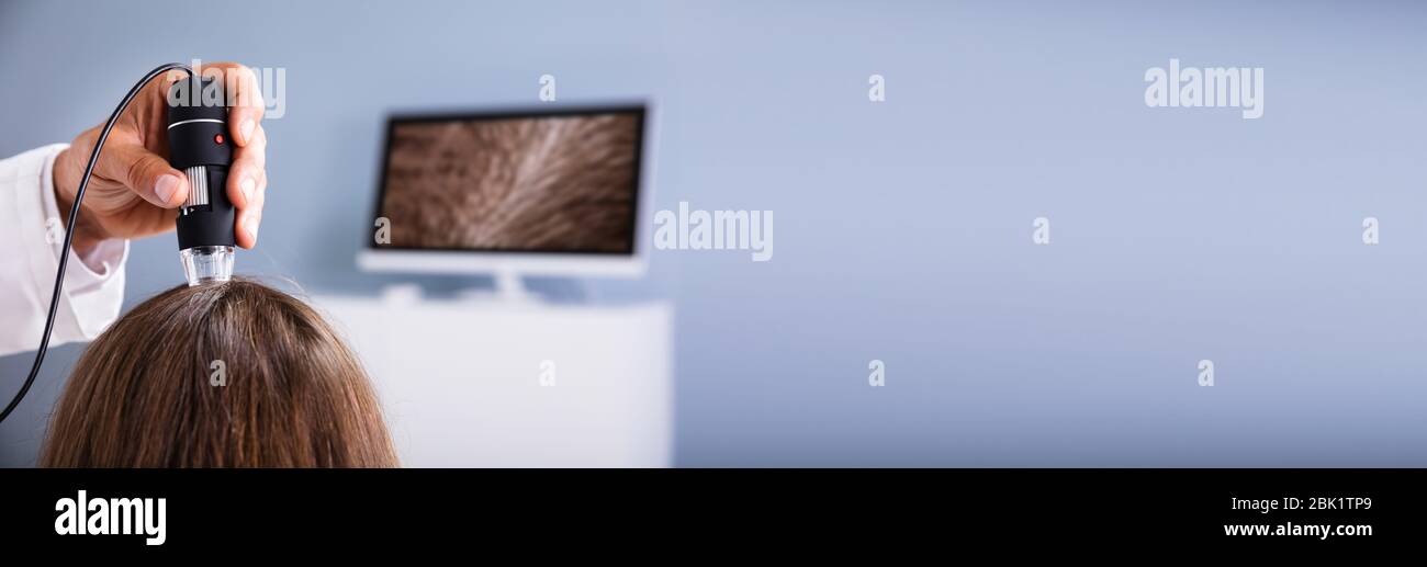 Hair Scalp Analysis For Dandruff. Woman Hair Fall Treatment Stock Photo