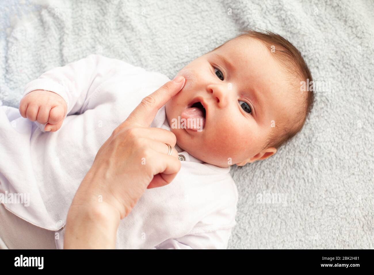 Baby with atopic dermatitis getting cream put. Care and Prevention Of