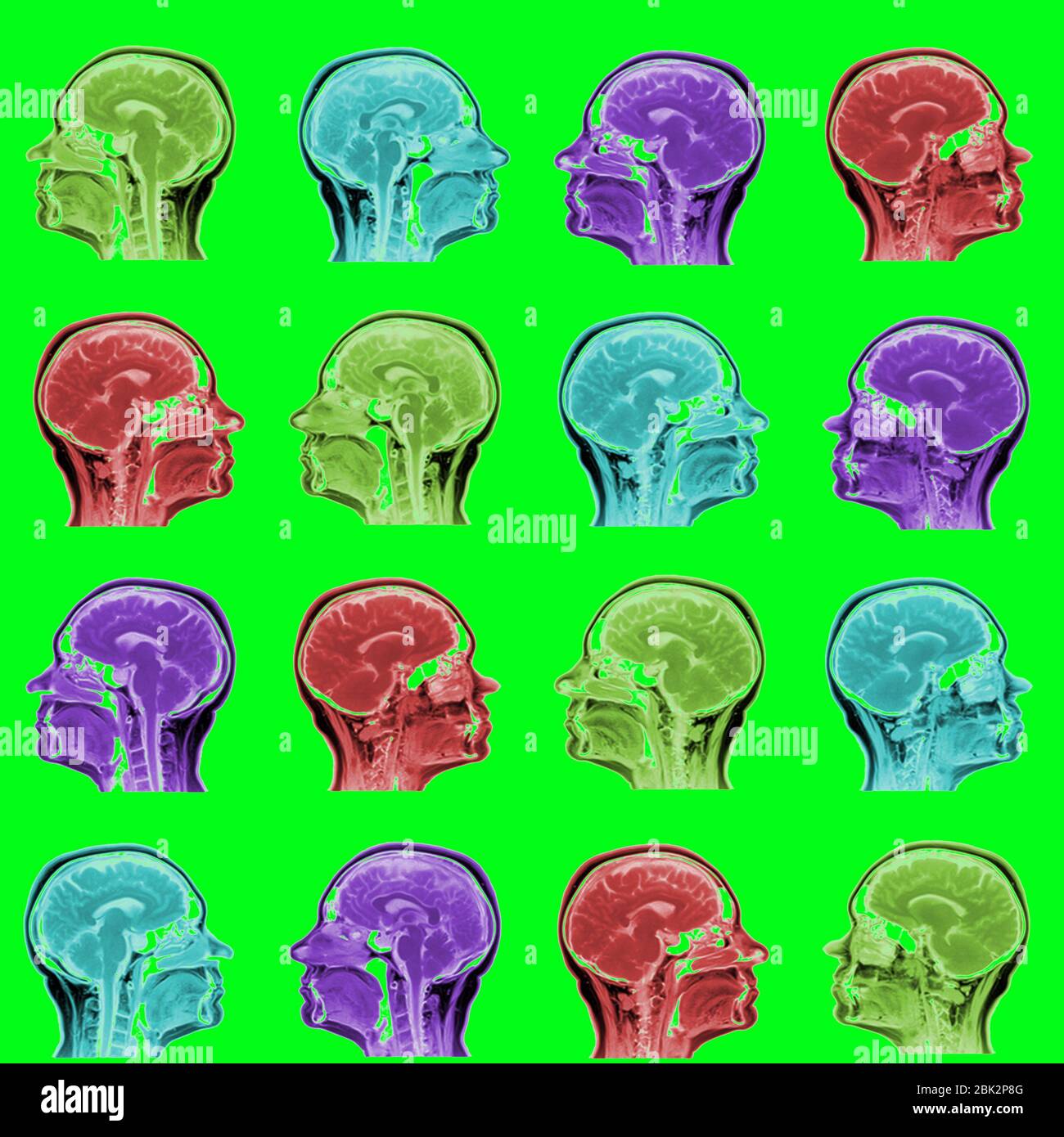 seamless pattern of MRI scans of sixty years old caucasian female head in sagittal or longitudinal plane - colored heads on acid green background Stock Photo