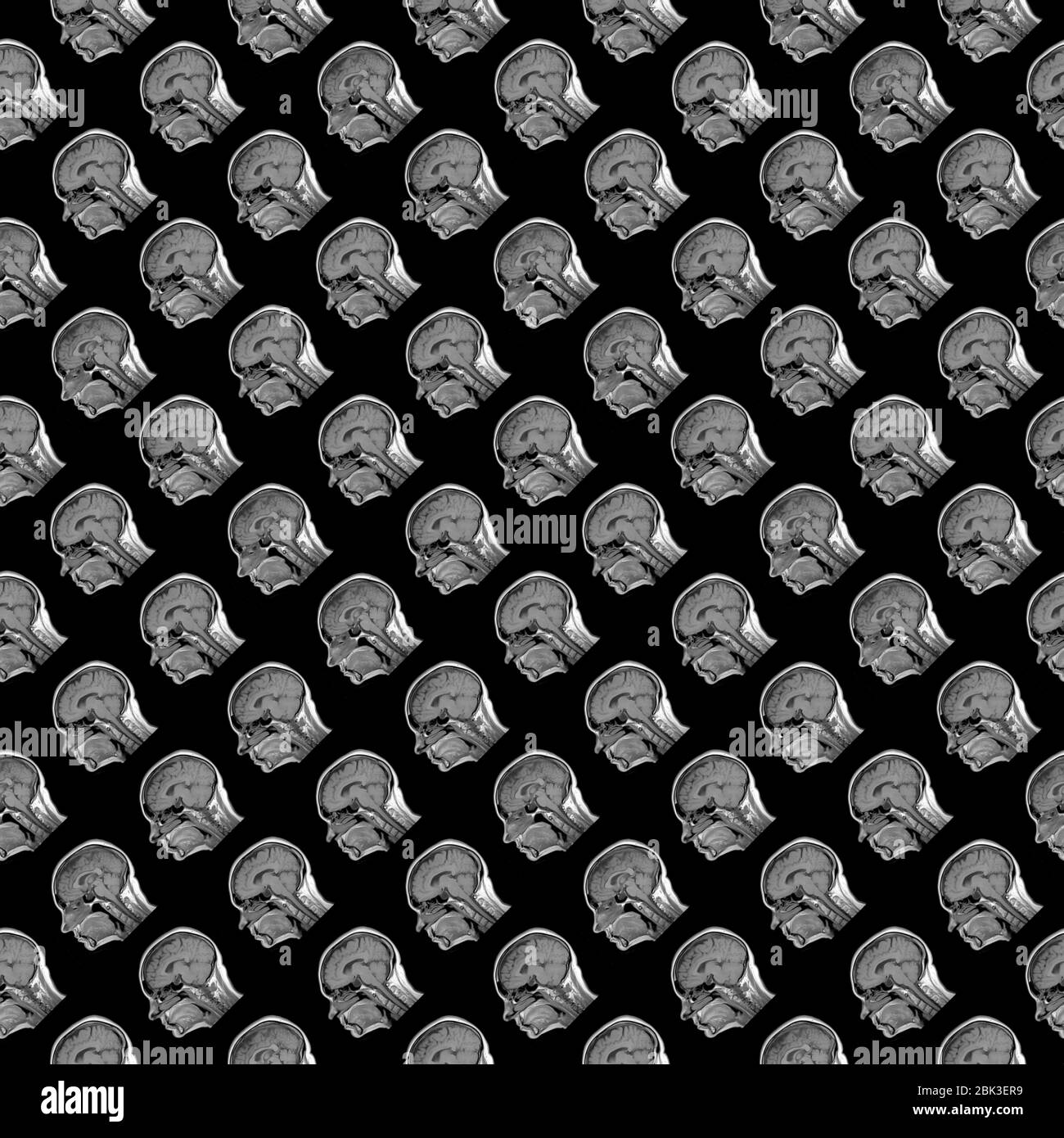 seamless pattern of sagittal MRI scans of sixty years old caucasian ...