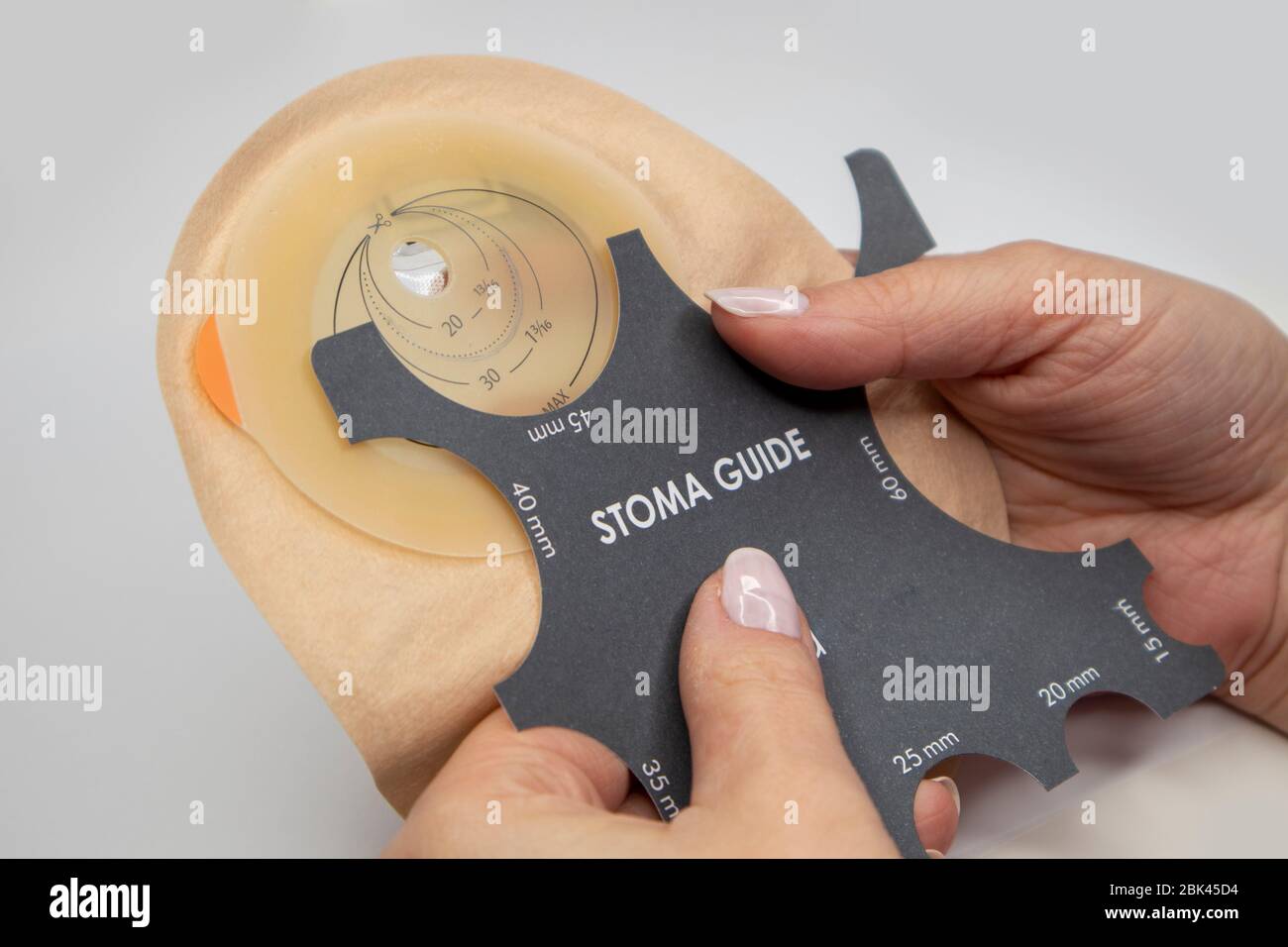 Top view on colostomy bag needed after colostomy surgery colon cancer treatment. Ostomy bag