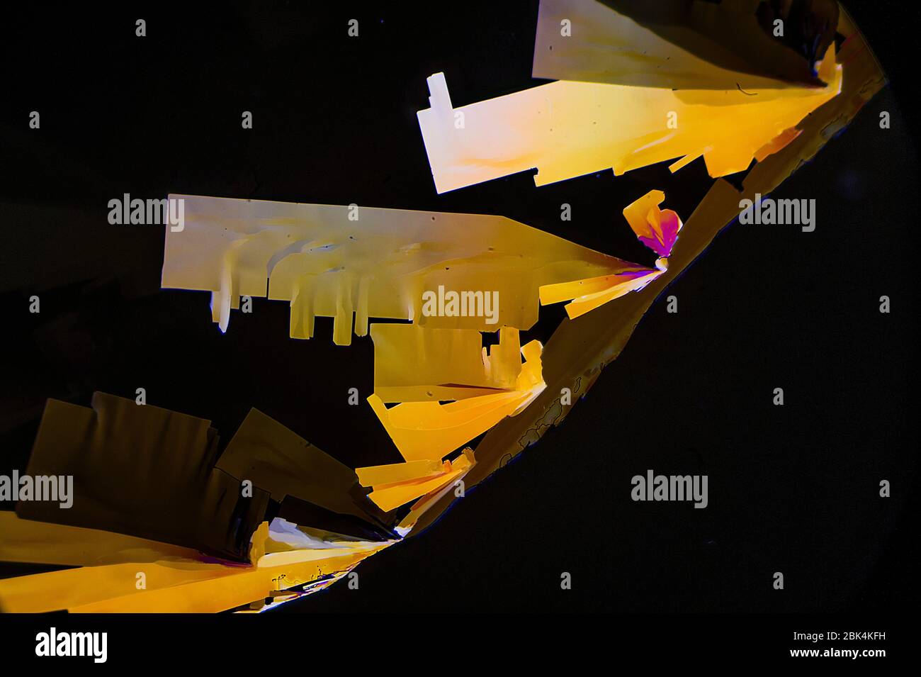 Vitamin C by polarised light microscopy Stock Photo