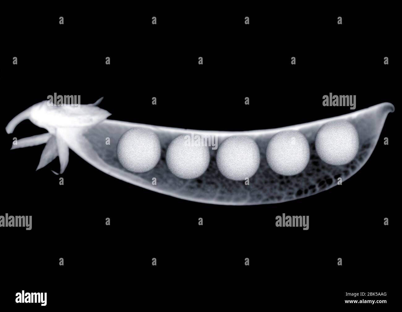 Five peas in a pod, X-ray. Stock Photo