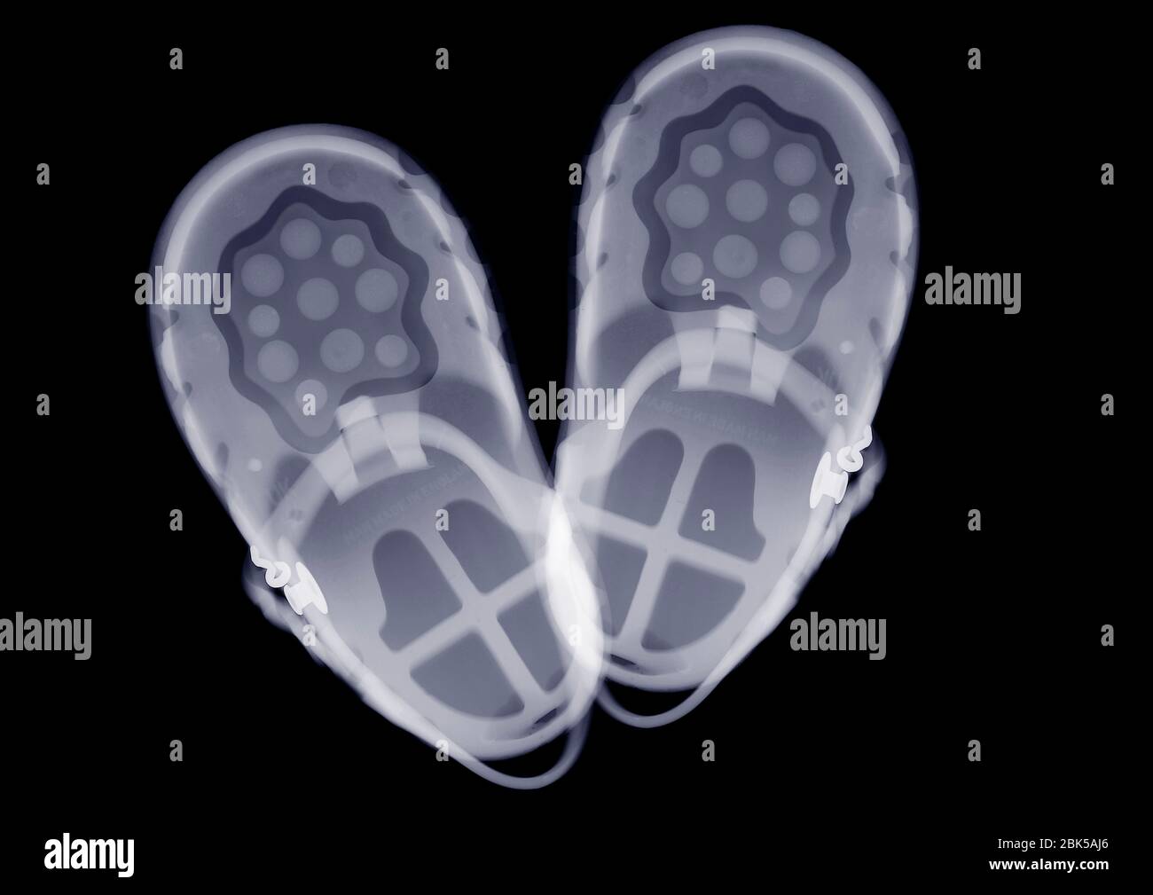 Children's jelly shoes, X-ray. Stock Photo