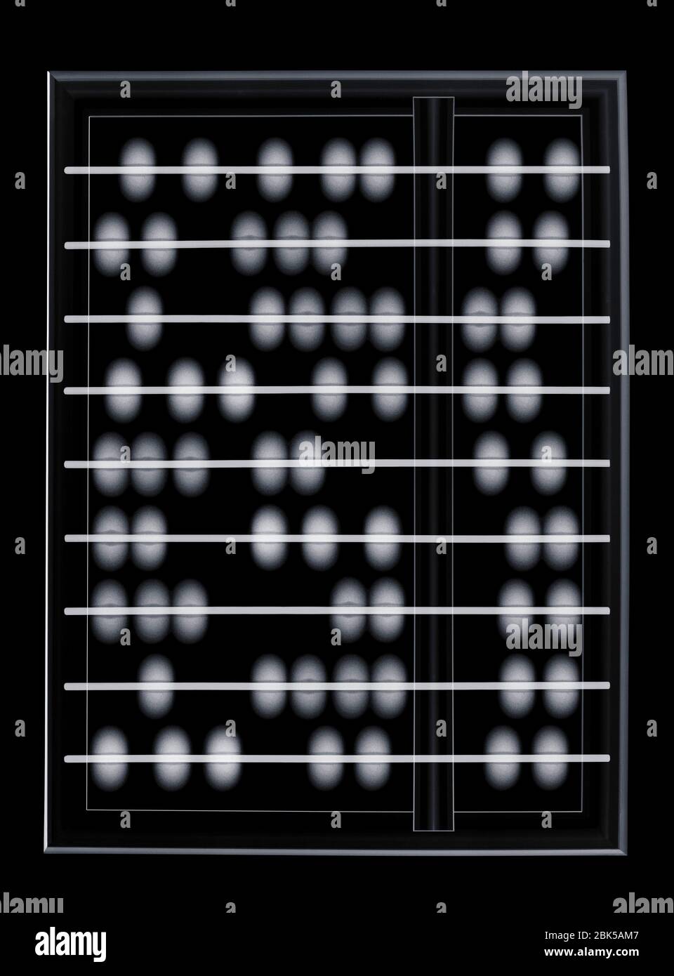 Abacus, X-ray. Stock Photo